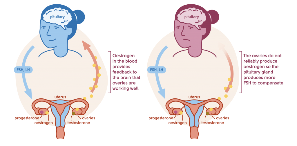 Brain fog My Menopause Centre